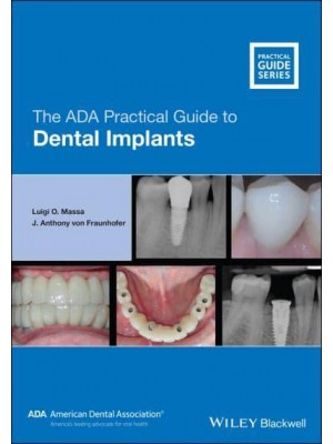 The ADA Practical Guide to Dental Implants - ADA Practical Guide
