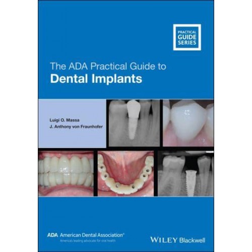The ADA Practical Guide to Dental Implants - ADA Practical Guide