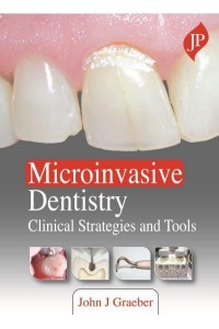 Microinvasive Dentistry Clinical Strategies and Tools