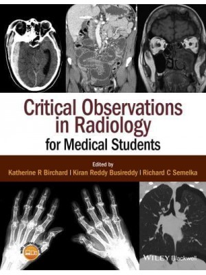 Critical Observations in Radiology for Medical Students