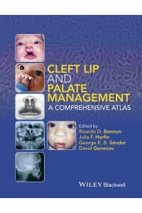 Cleft Lip and Palate Management A Comprehensive Atlas