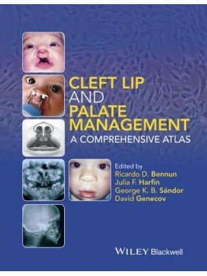 Cleft Lip and Palate Management A Comprehensive Atlas