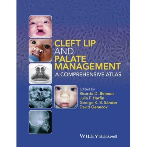 Cleft Lip and Palate Management A Comprehensive Atlas