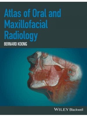 Atlas of Oral and Maxillofacial Radiology