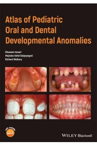 Atlas of Pediatric Oral and Dental Developmental Anomalies