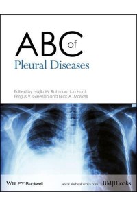 ABC of Pleural Diseases - ABC Series