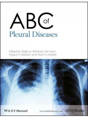 ABC of Pleural Diseases - ABC Series
