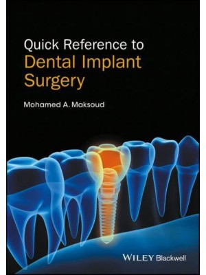 Quick Reference to Dental Implant Surgery