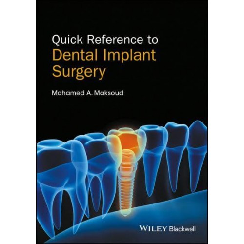Quick Reference to Dental Implant Surgery