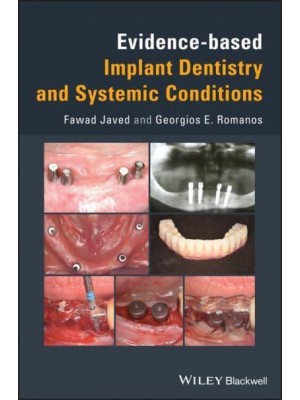 Evidence-Based Implant Dentistry and Systemic Conditions