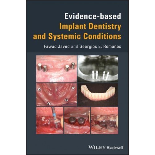 Evidence-Based Implant Dentistry and Systemic Conditions