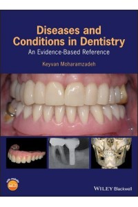 Diseases and Conditions in Dentistry An Evidence-Based Reference