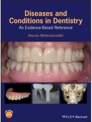 Diseases and Conditions in Dentistry An Evidence-Based Reference