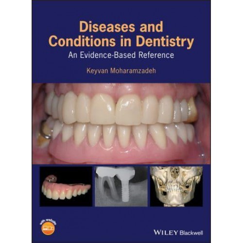 Diseases and Conditions in Dentistry An Evidence-Based Reference