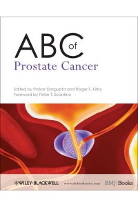 ABC of Prostate Cancer - ABC Series
