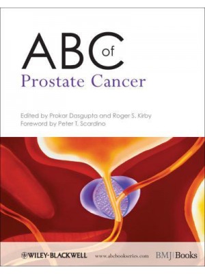 ABC of Prostate Cancer - ABC Series