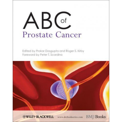 ABC of Prostate Cancer - ABC Series