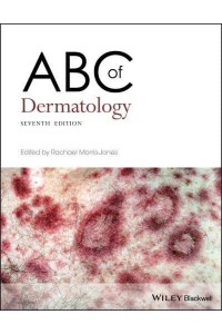ABC of Dermatology - ABC Series