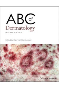 ABC of Dermatology - ABC Series
