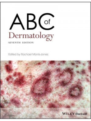 ABC of Dermatology - ABC Series