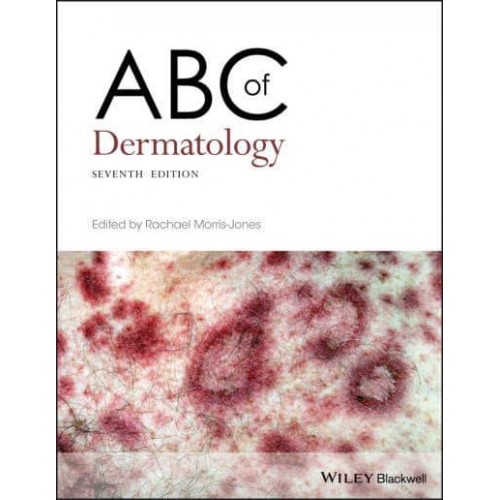 ABC of Dermatology - ABC Series