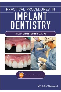 Practical Procedures in Implant Dentistry