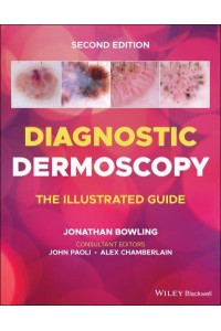 Diagnostic Dermoscopy The Illustrated Guide