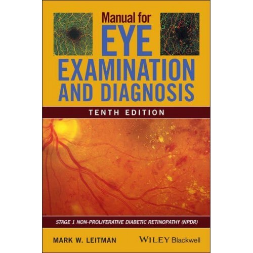Manual for Eye Examination and Diagnosis