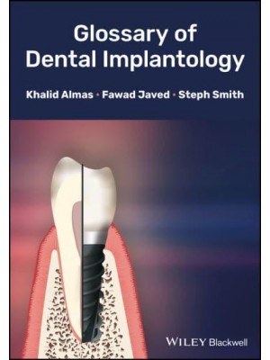 Glossary of Dental Implantology