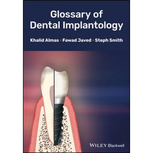 Glossary of Dental Implantology