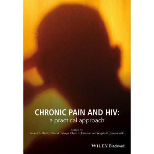 Chronic Pain and HIV A Practical Approach