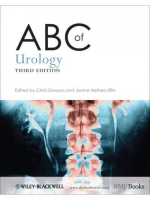 ABC of Urology - ABC Series