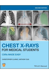 Chest X-Rays for Medical Students