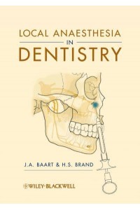 Local Anaesthesia in Dentistry