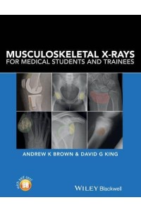 Musculoskeletal X-Rays for Medical Students and Trainees