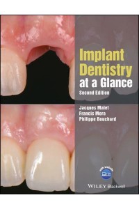 Implant Dentistry at a Glance - At a Glance (Dentistry)