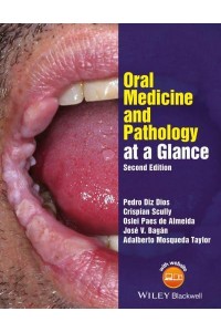 Oral Medicine and Pathology at a Glance - At a Glance Series