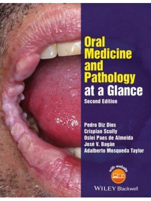 Oral Medicine and Pathology at a Glance - At a Glance Series