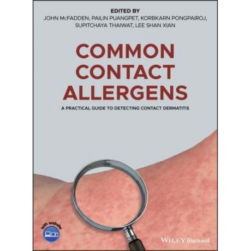 Common Contact Allergens A Practical Guide to Testing for Allergic Contact Dermatitis