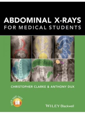 Abdominal X-Rays for Medical Students