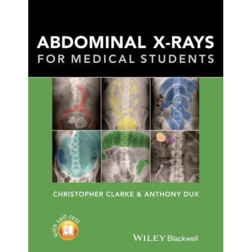 Abdominal X-Rays for Medical Students