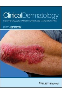 Clinical Dermatology