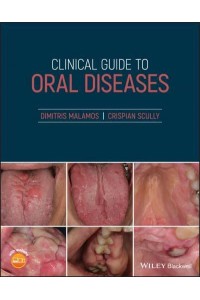Clinical Guide to Oral Diseases