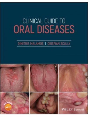 Clinical Guide to Oral Diseases