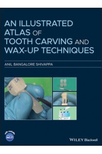 An Illustrated Atlas of Tooth Carving and Wax-Up Techniques