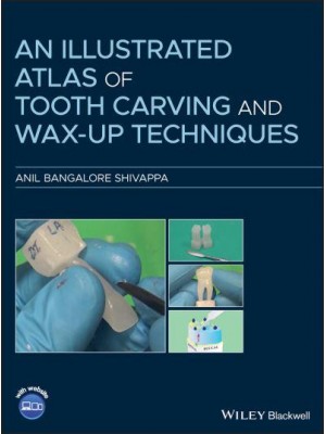 An Illustrated Atlas of Tooth Carving and Wax-Up Techniques