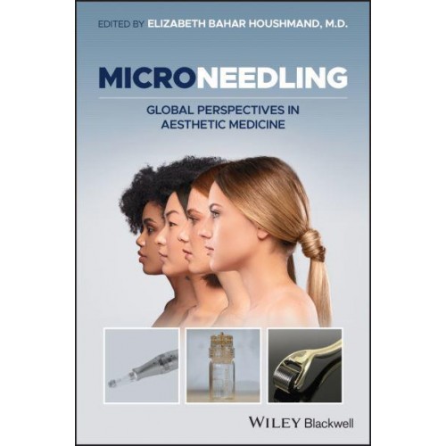 Microneedling Global Perspectives in Aesthetic Medicine