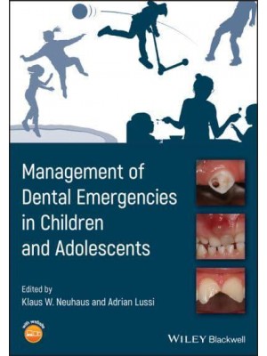 Management of Dental Emergencies in Children and Adolescents