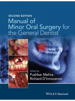 Manual of Minor Oral Surgery for the General Dentist