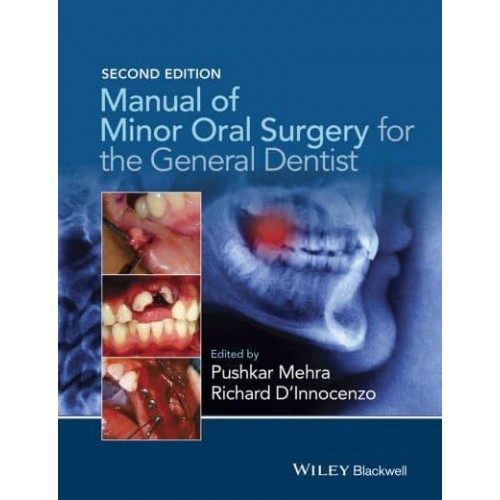Manual of Minor Oral Surgery for the General Dentist